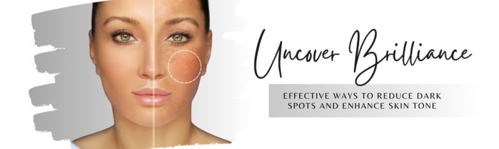 Uncover Brilliance: Effective Ways to Reduce Dark Spots and Enhance Skin Tone - beEMe Med Spa Houston