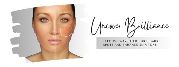 Uncover Brilliance: Effective Ways to Reduce Dark Spots and Enhance Skin Tone - beEMe Med Spa Houston