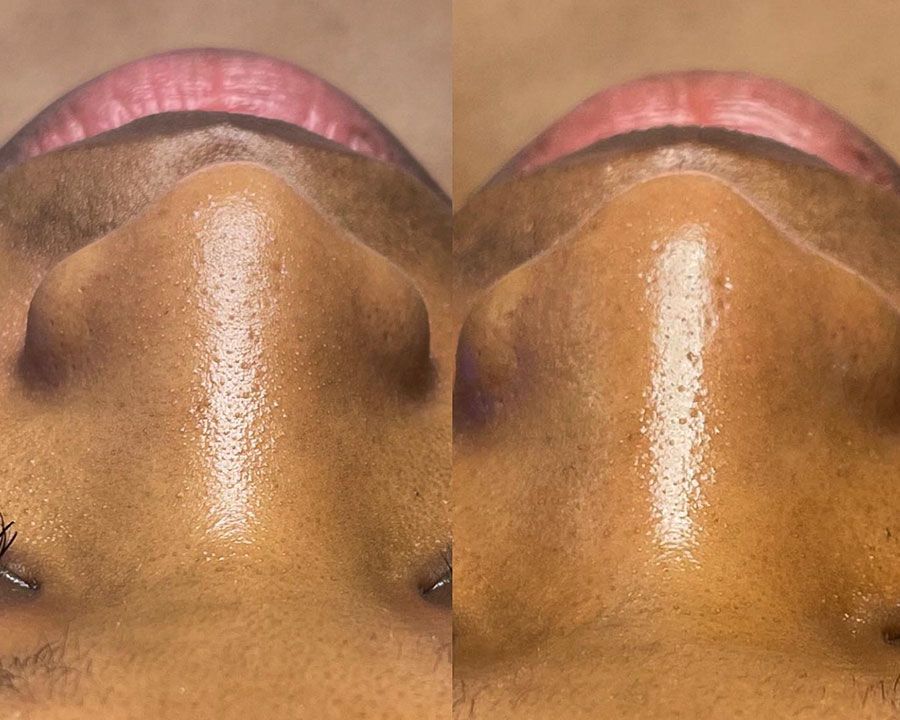 beeme-med-spa_houston-medical-spa_hydrafacials-02